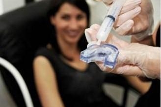 Découvrez le Centre de Blanchiment : Sourire Minute !