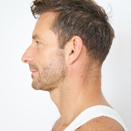 Anthonydouay