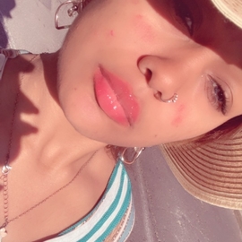 NoXia34