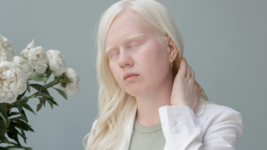 Casting homme et femme atteint d’albinisme entre 20 et 60 ans pour tournage film publicitaire